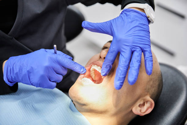 Best Emergency Wisdom Teeth Removal in Jefferson, GA