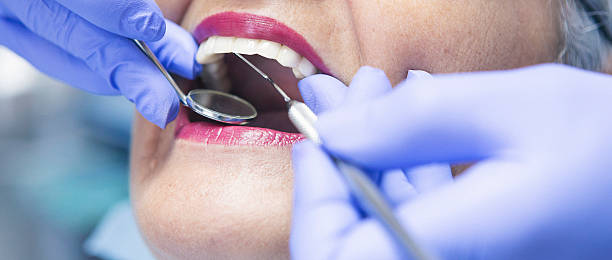 Best Emergency Tooth Extraction in Jefferson, GA